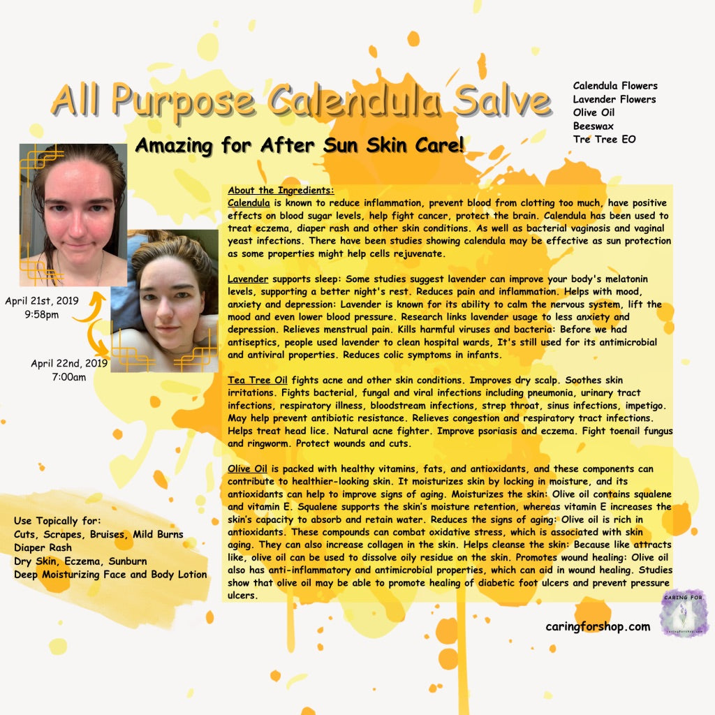 All Purpose Calendula Salve | Salve | B1G1-25%off | Apothecary by Caring For... | M/B/T